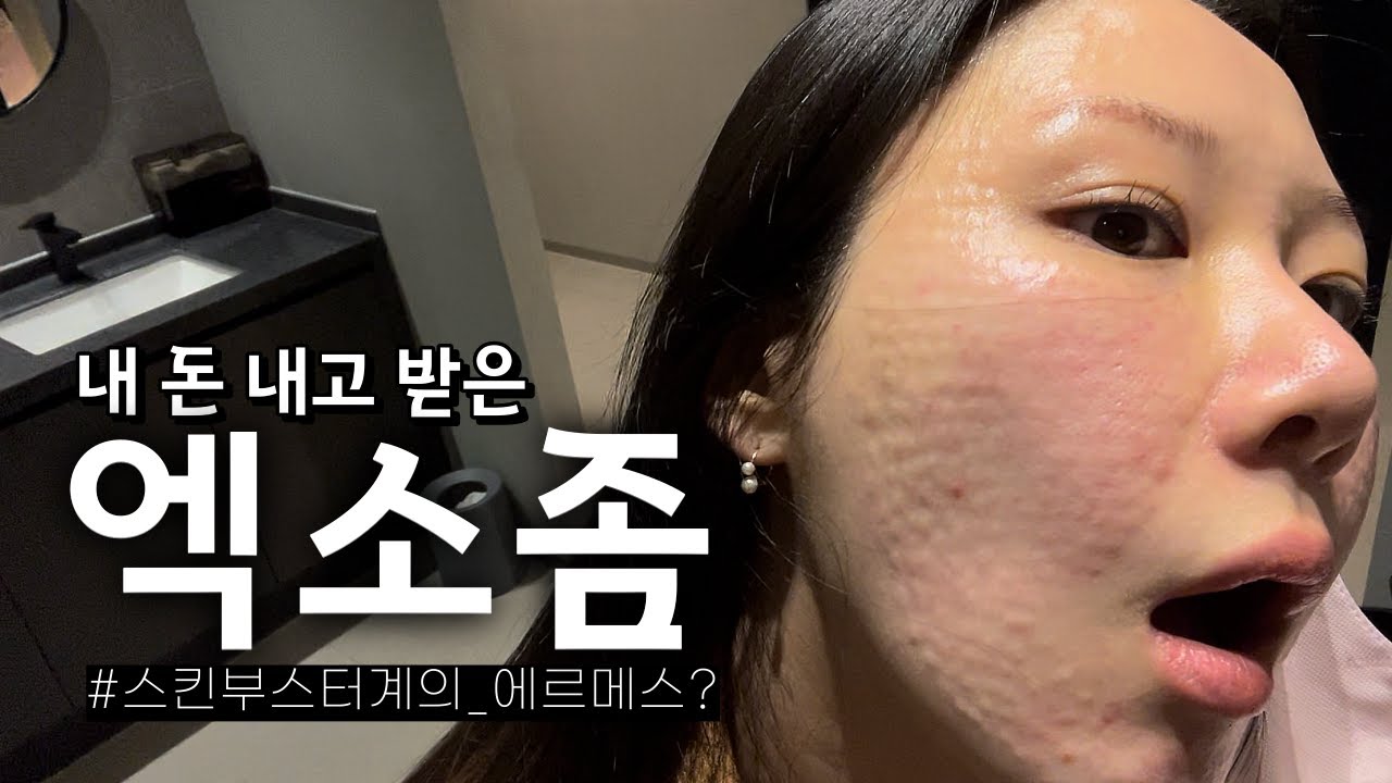 Exosome Skin Booster